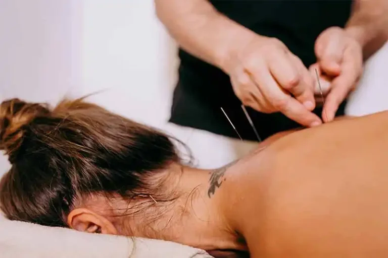 google-ads-for-acupuncture